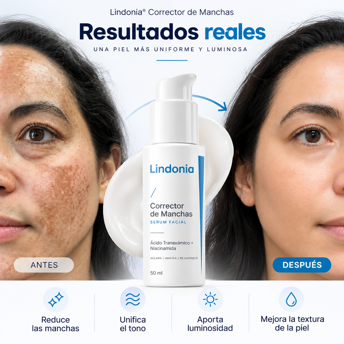 Lindonia® Crema Coreana Antimanchas: Aclara manchas desde la primera semana