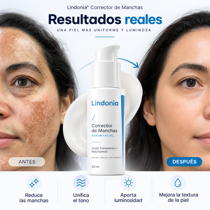 Lindonia® Crema Coreana Antimanchas: Aclara manchas desde la primera semana